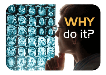 Image of researcher viewing MRI films at a lightbox