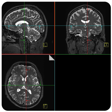 Prisma console diplay of MRI scans