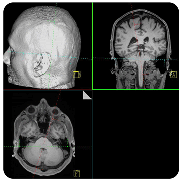 Prisma console showing MRI scans with 3D reconstruction