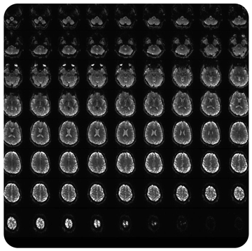 Prisma MR console showing echo-planar images