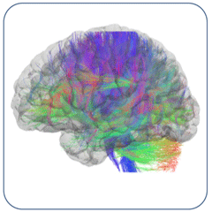 multicolored brain image